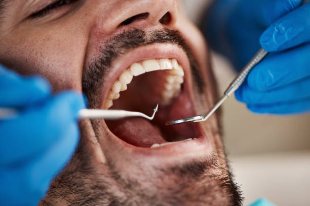 Best Emergency Denture Repair in Del Rey Oaks, CA